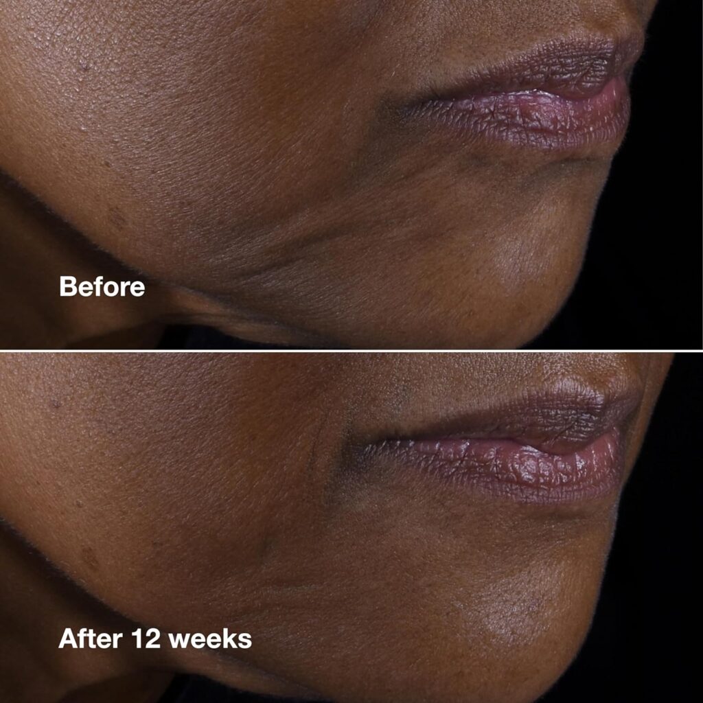 Clinique smart clinical repair affect after 12 months use